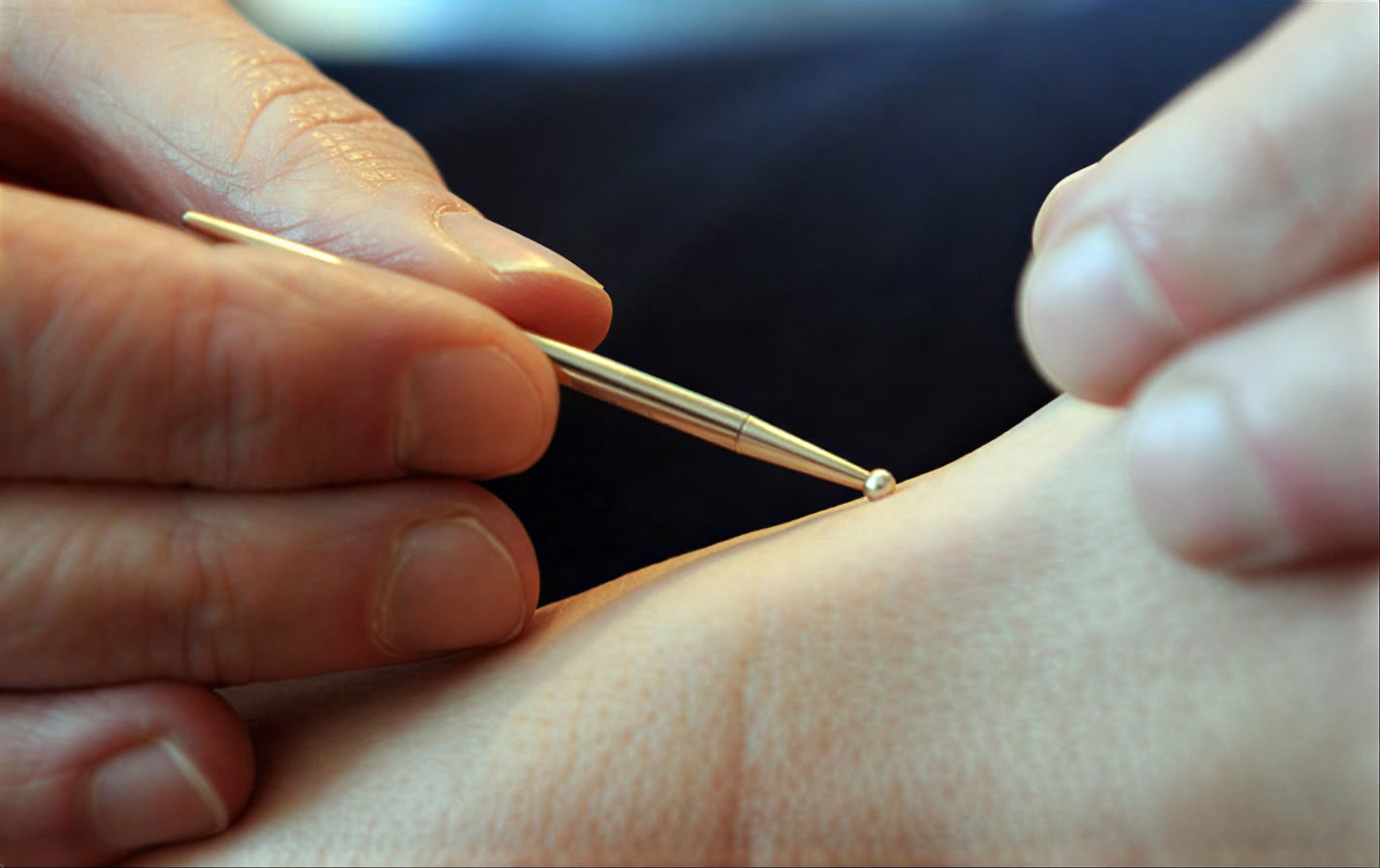 Nærende Liv LA • Akupunktur & kinesisk medicin